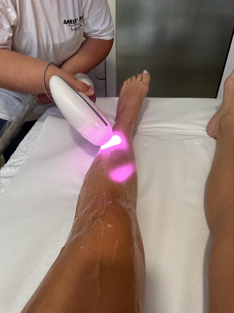 Sessão de depilação a laser
